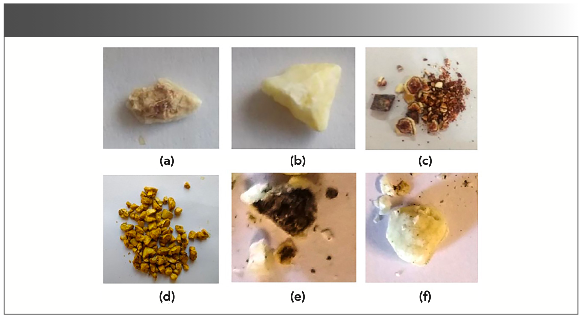 FIGURE 1: Photographs of gallstone samples (G1–G6) used in the present study.