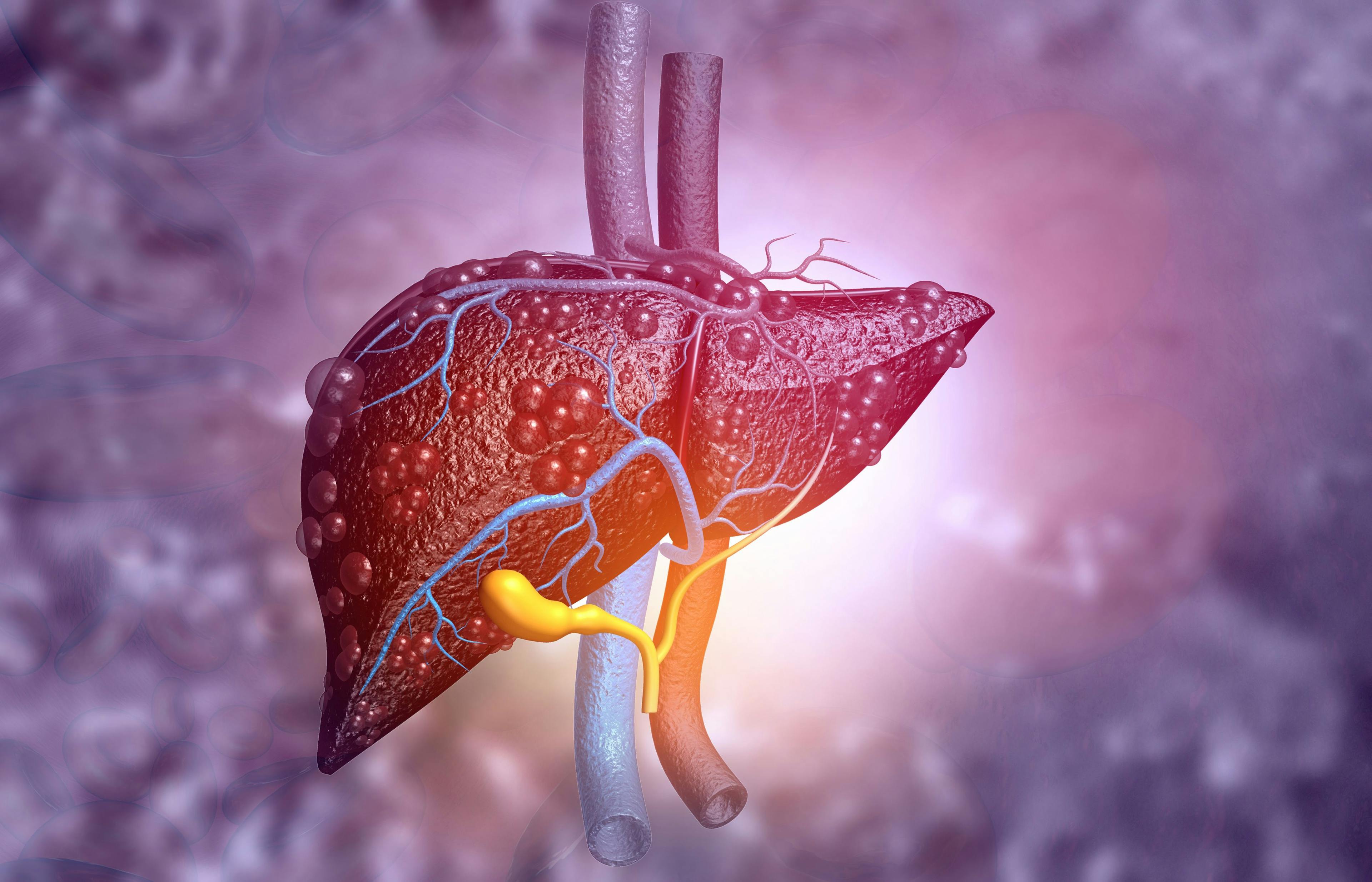 3d illustration of Abstract medical background with Diseased liver | Image Credit: © Rasi - stock.adobe.com
