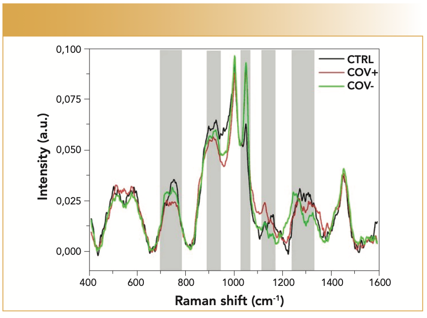 FIGURE 1: Differences in control (black) Covid-positive (red), and Covid-negative (green) SERS spectra of saliva, from reference (3). Shared under Creative Commons Attribution 4.0 International License.