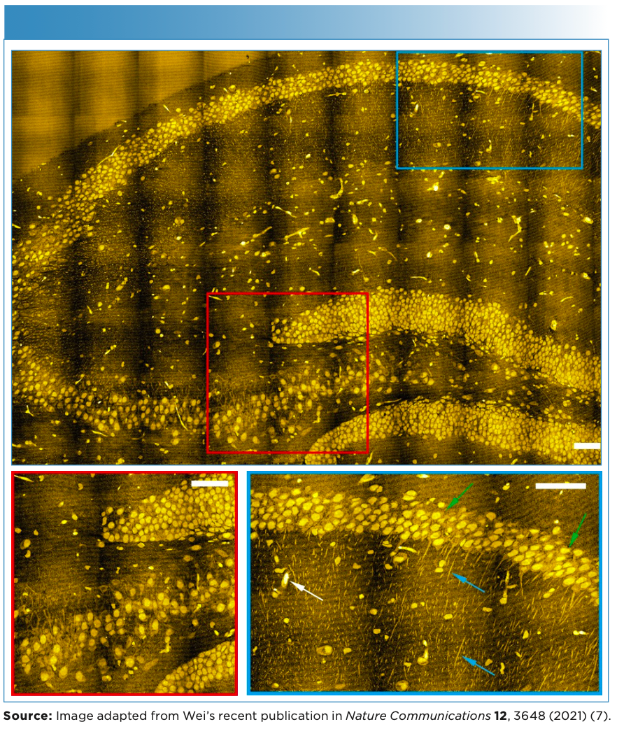 Top: A mosaic super-resolved image of hippocampal tissue from a label-free SRS-imaging tailored sample-expansion strategy that was termed as VISTA (Vibrational Imaging of Swelled Tissues and Analysis). Bottom: zoomed-in high-resolution view from color-boxed areas (left: red box; right: blue box) and selected regions from the top image. Representative neuronal cell bodies, neuronal processes, and likely blood vessel cross-sections are indicated by green, blue, and white arrows, respectively.