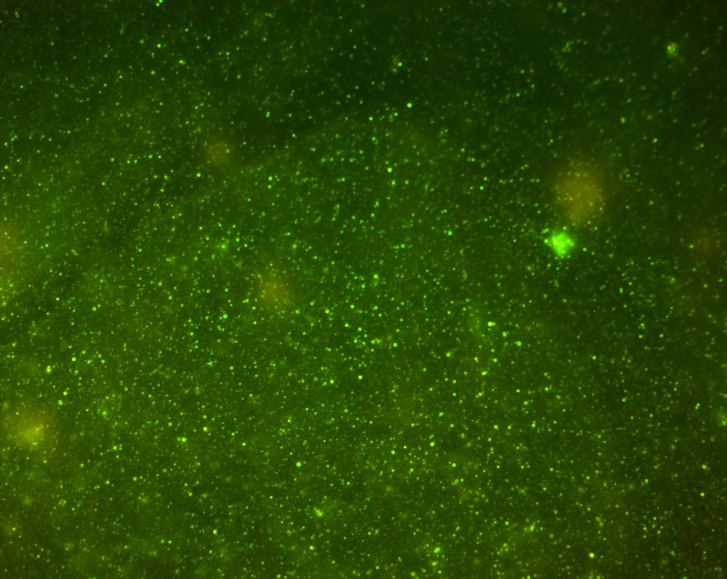 Micrography, microphotography of vesicles, particles or green fluorescent cells for scientific research, taken under a high-tech microscope. Fluorescence of curcumin and other fluorophores of interest | Image Credit: © DavidBautista - stock.adobe.com