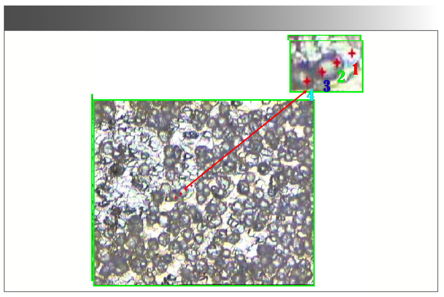 FIGURE 2: The combination of silver gel and serum image under a microscope (with close-up insert).