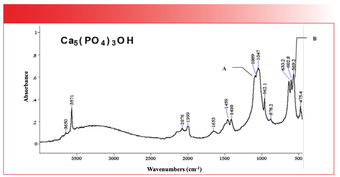 FIGURE 7: The infrared spectrum of hydroxyapatite, Ca(PO4)3OH.
