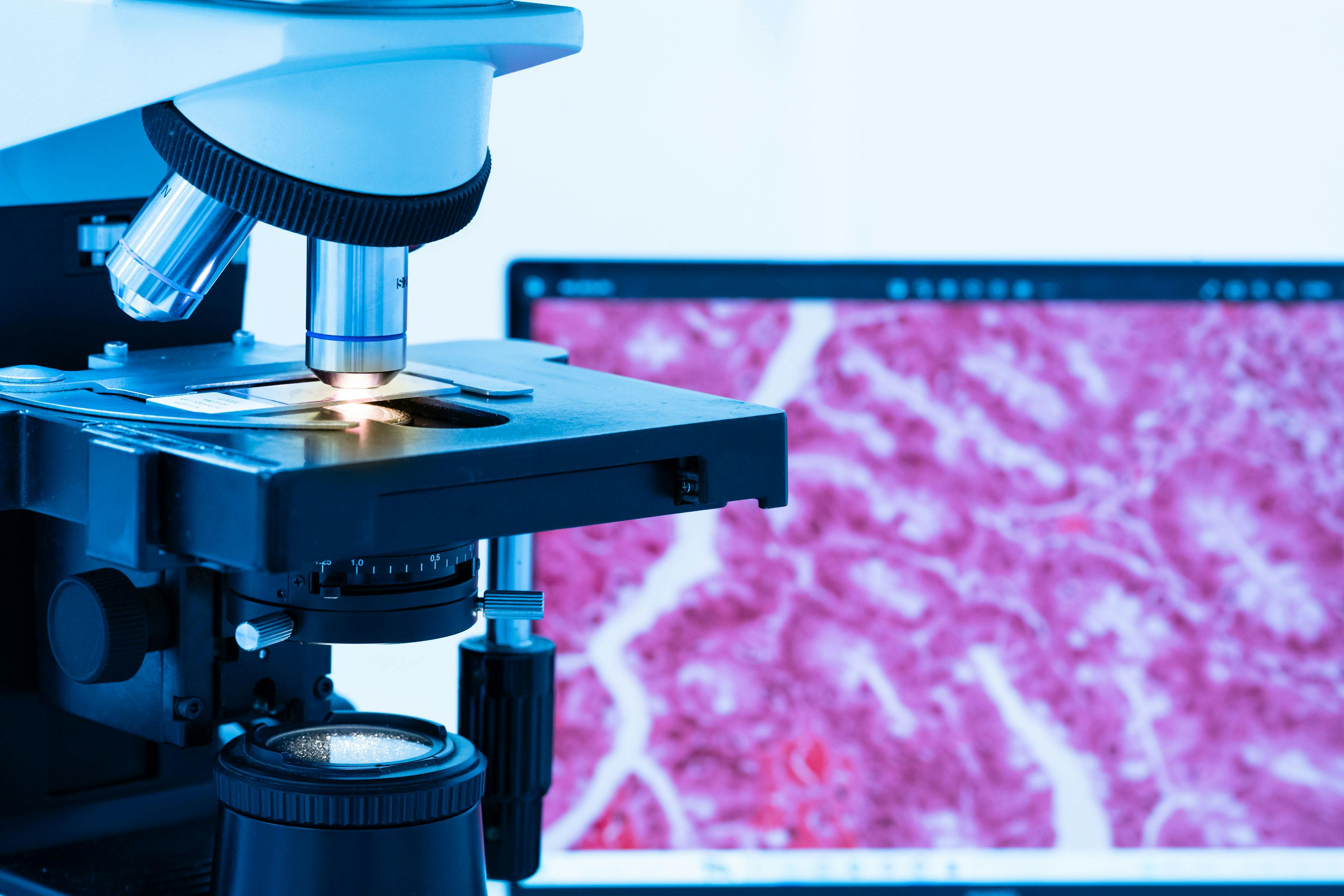 Modern microscope and human tissue section slide with computer monitor show glandular image. Medical patholology and cytology technology concept. Selective focus. | Image Credit: © arcyto - stock.adobe.com