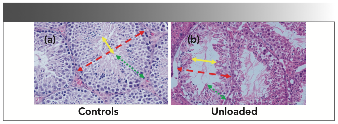 FIGURE 1: (a,b) Changes in the testicular architecture in the hindlimb of unloaded mice.
