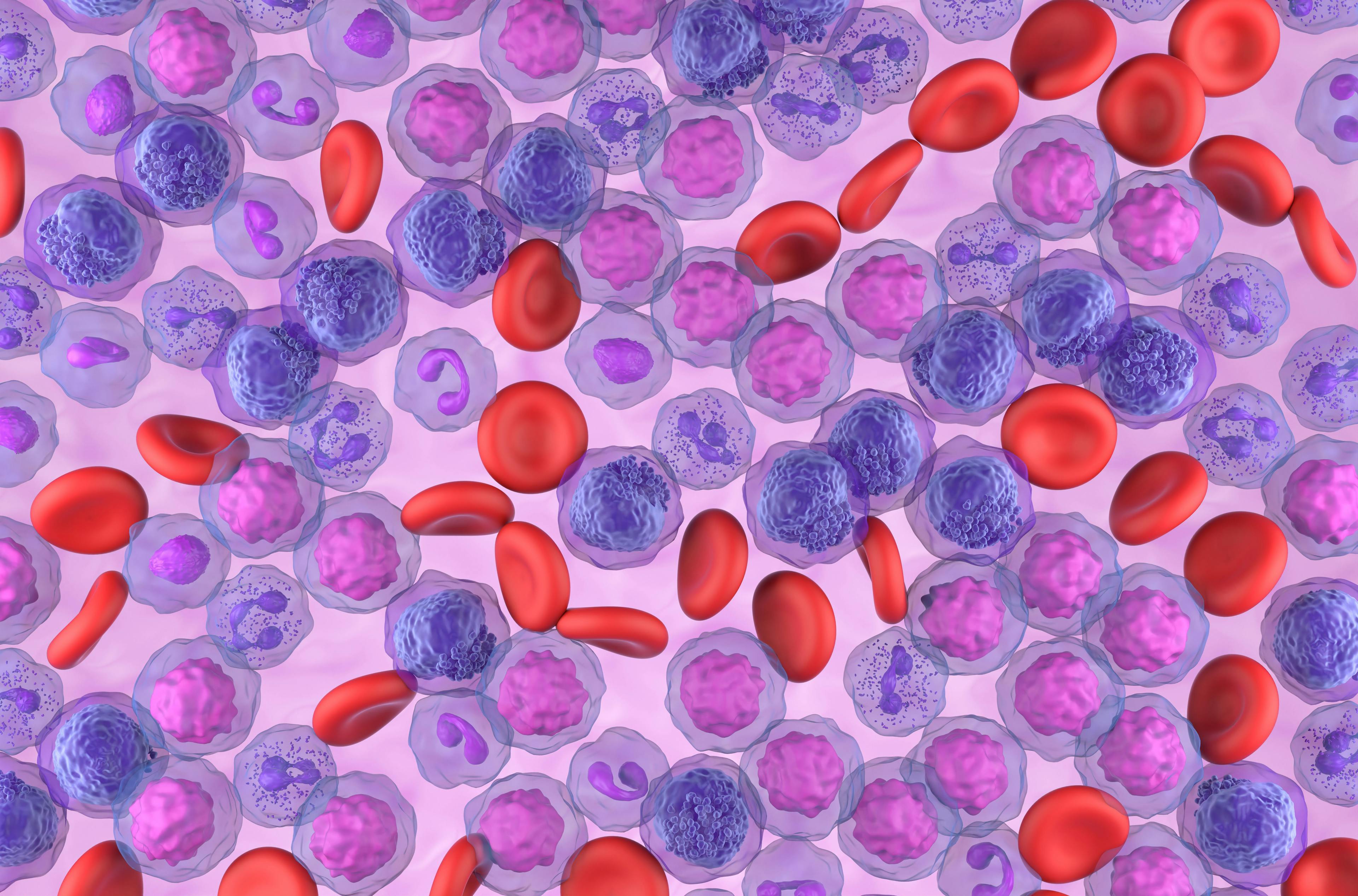 Acute myeloid leukemia (AML) cells field - top view 3d illustration | Image Credit: © LASZLO - stock.adobe.com