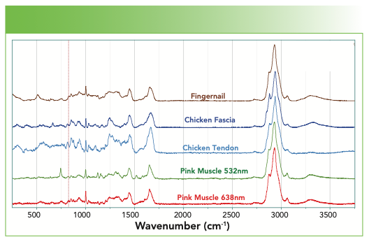 FIGURE 9: From top to bottom, Raman spectrum of a fingernail, chicken fascia, chicken tendon, pink muscle (532 nm excitation), and pink muscle (638 nm excitation).
