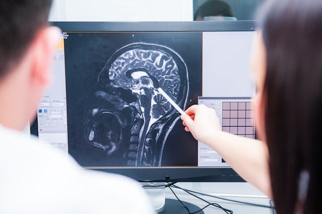  Doctors consider and discuss magnetic resonance image (MRI) of the brain. Back view, selective focus | Image Credit: © okrasiuk - stock.adobe.com