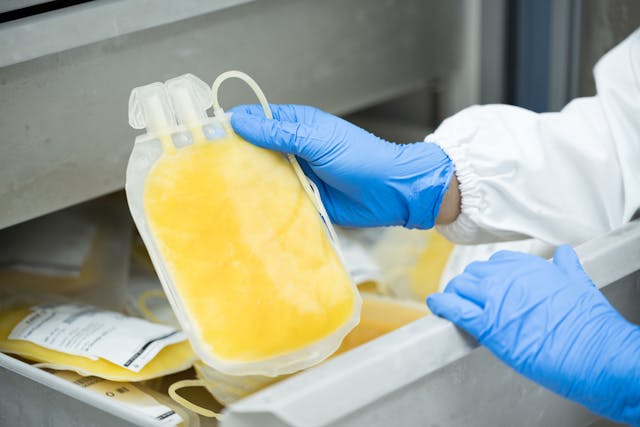 Doctor hand wearing blue gloves holding fresh frozen plasma bag in storage blood refrigerator at blood bank unit laboratory. Human plasma for covid-19 patients treatment | Image Credit: © arcyto - stock.adobe.com