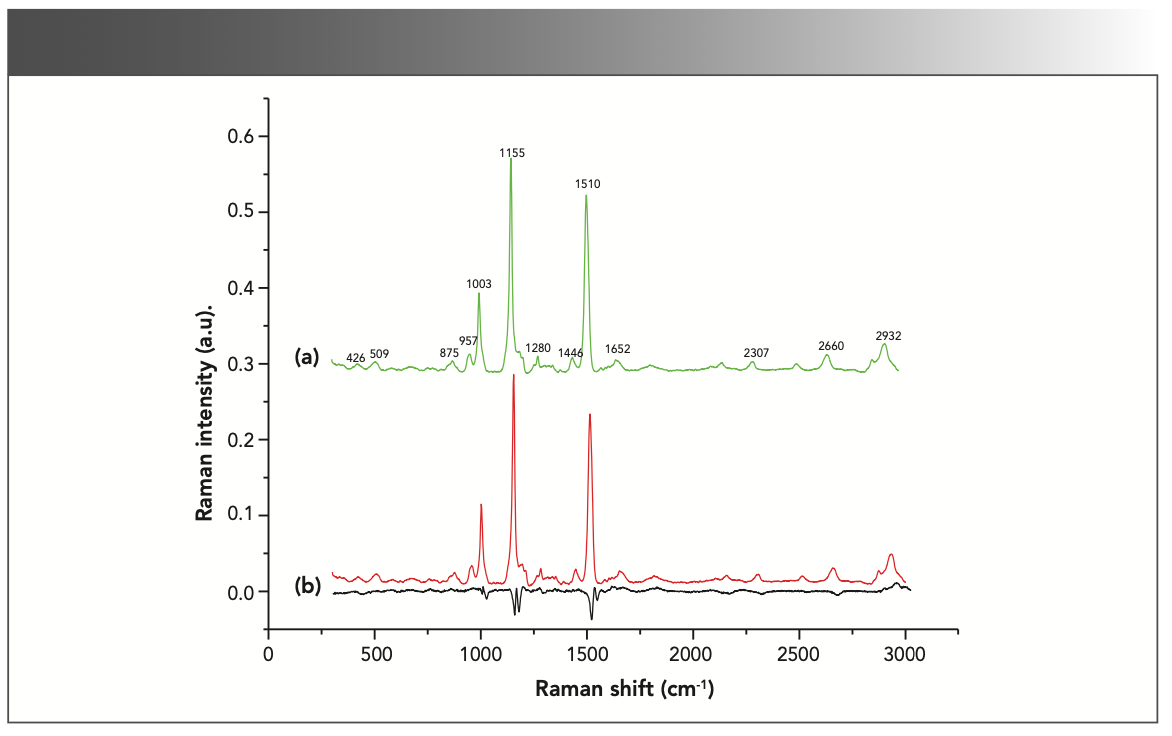FIGURE 3: Normalized average spectra and difference spectrum (black) of samples from hepatitis B patients (red) and non-hepatitis B patients (green).